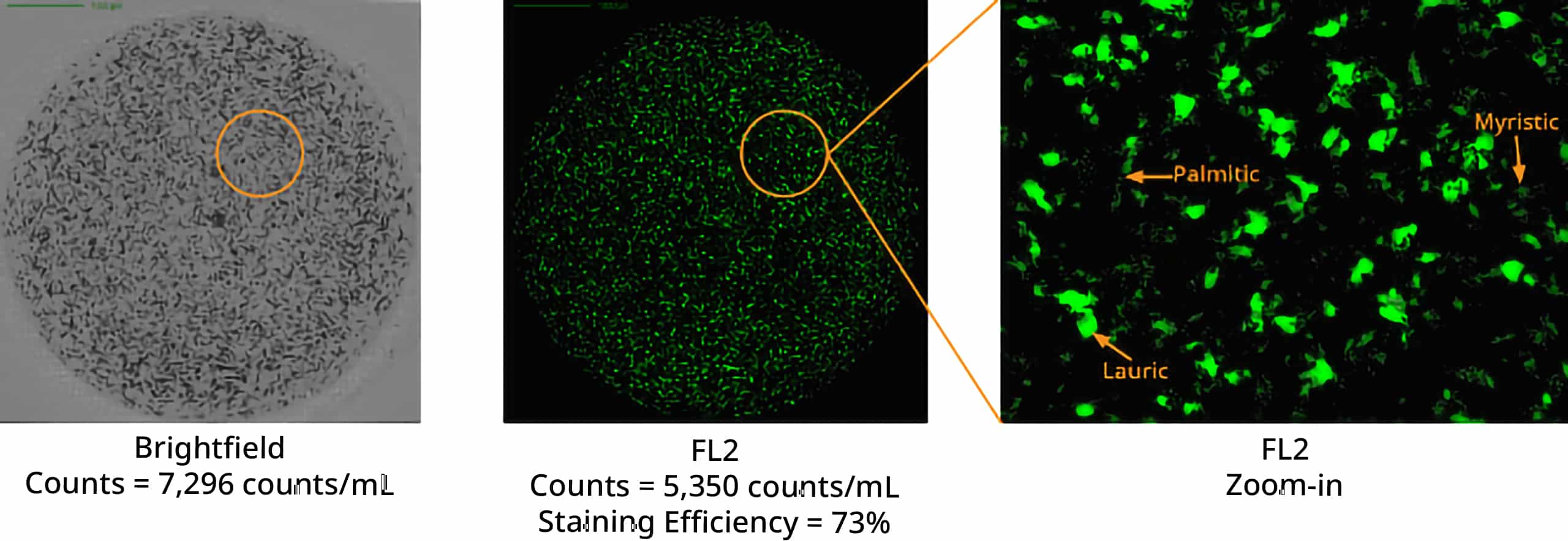 Aura technology faciliatetes identification of polysorbate degradation products