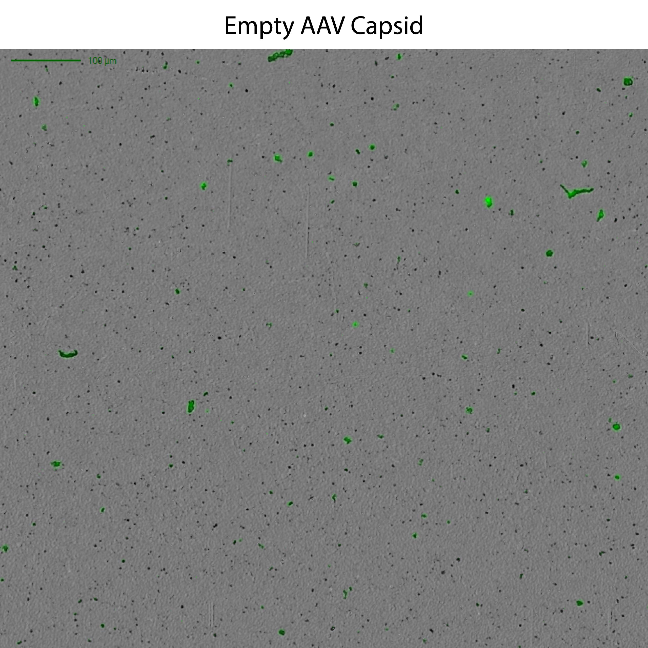 Empty AAV capsids are easily idenfied using the Aura GT system.