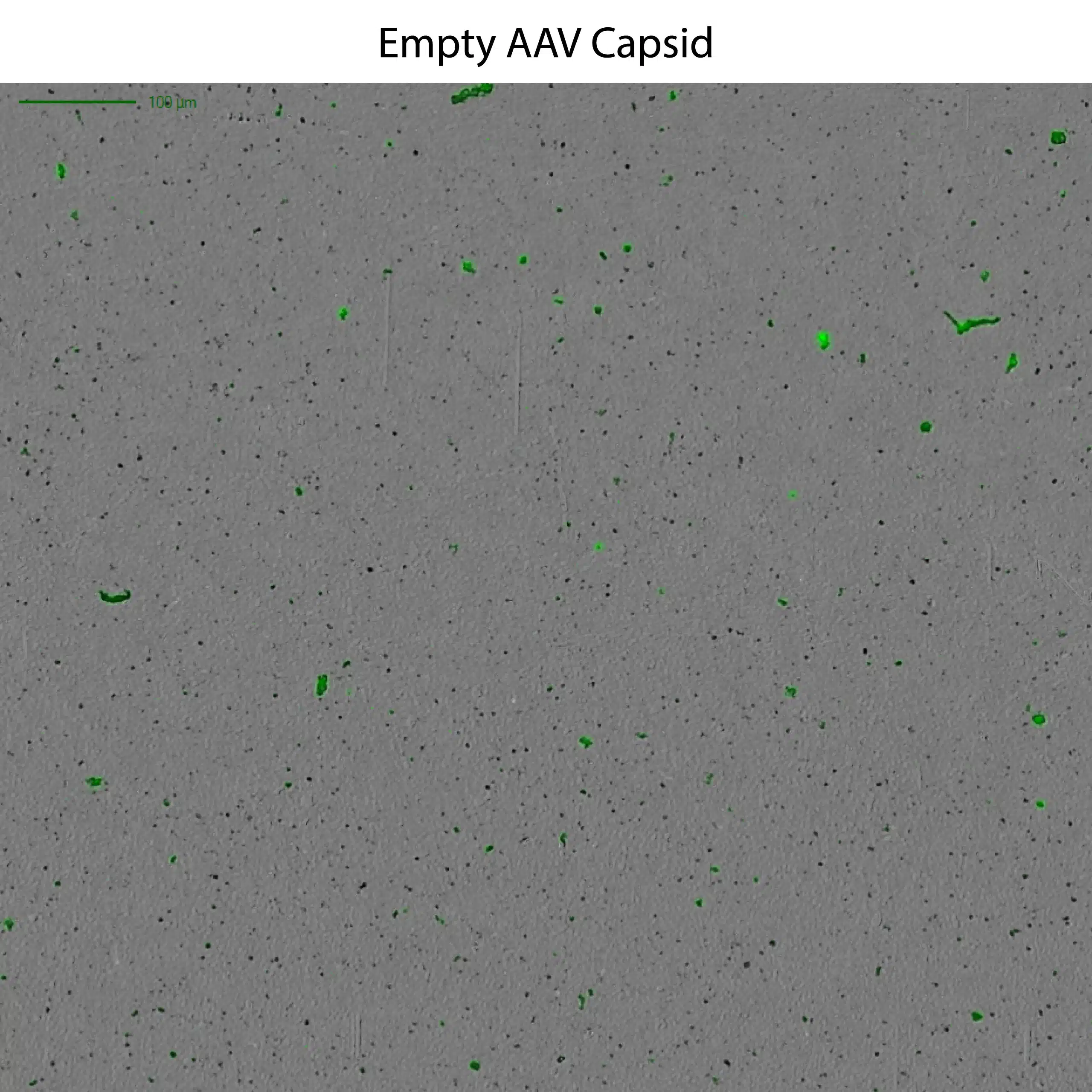 Empty AAV capsids are easily idenfied using the Aura GT system.