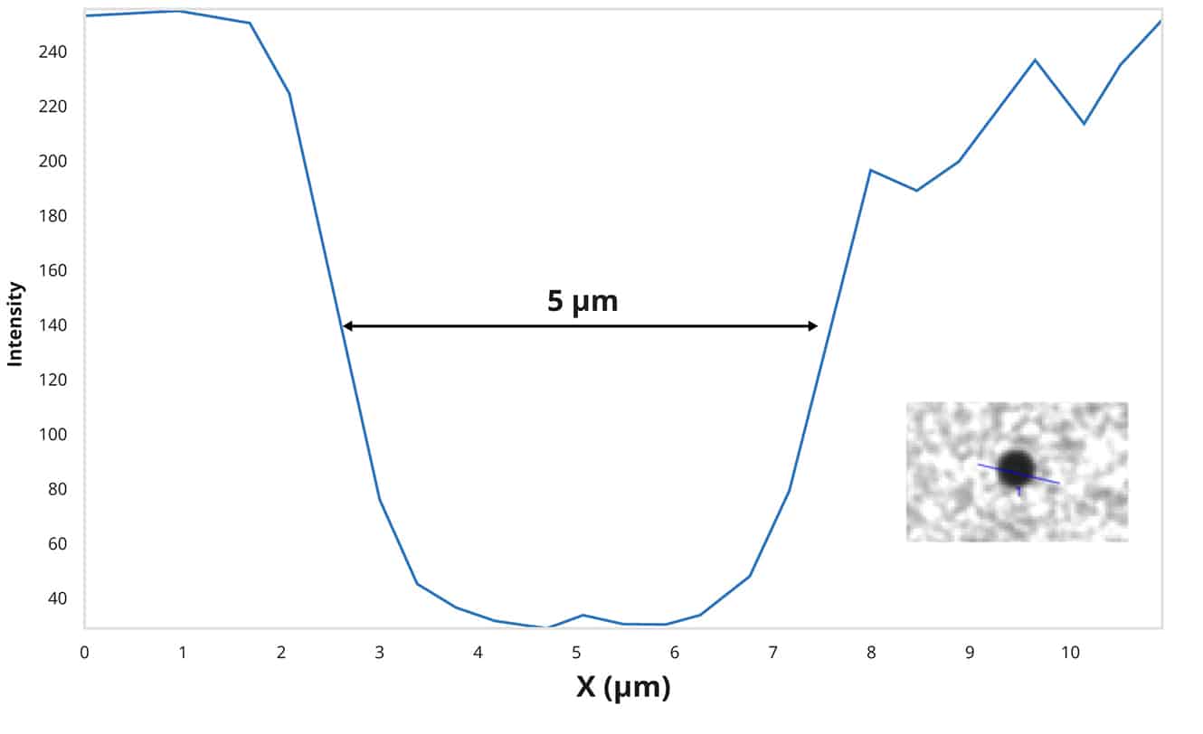 Aura platform is the only technology to reliably detect residual dynabeads.