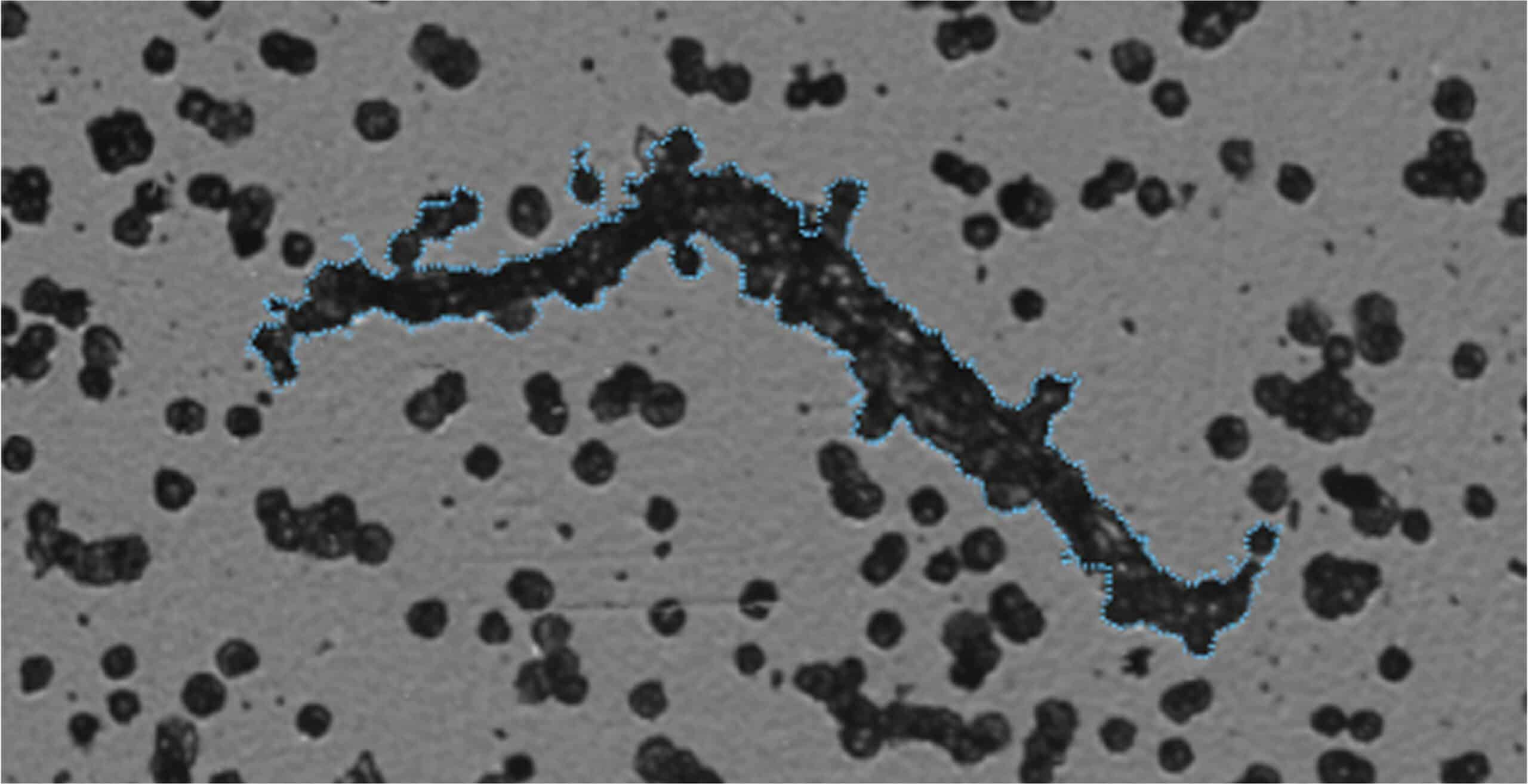 cell therapy product purity complex aggregate BF 1 large@2x scaled