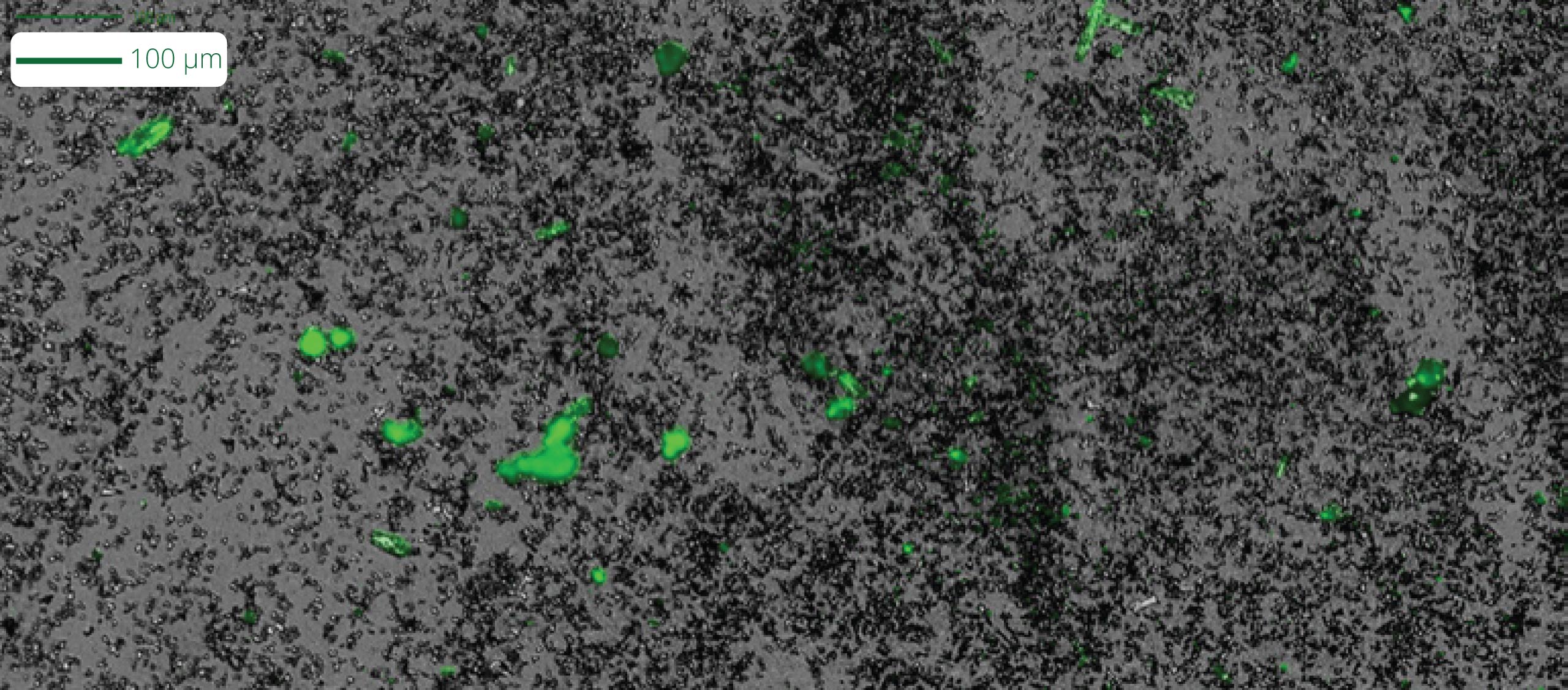 Easily distinguish between LNPs and DNA aggregates with the Aura GT.