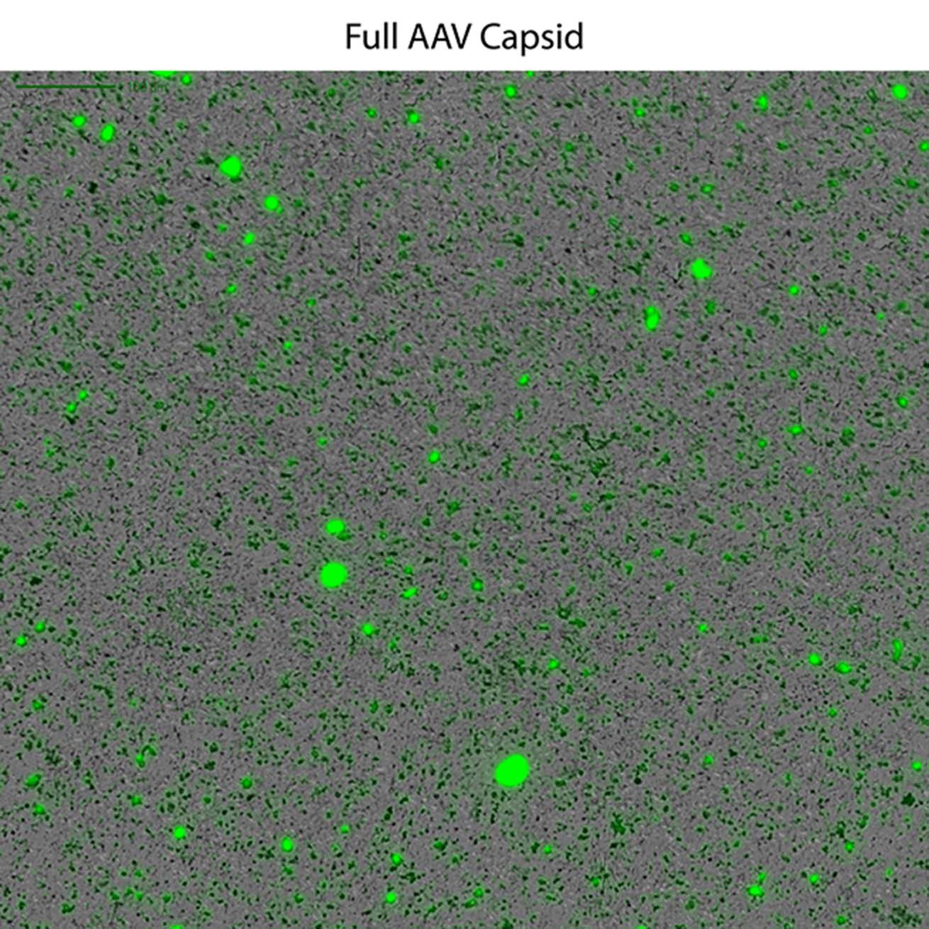 Full AAV capsids are rapidly visualized with fluorescent DNA using the Aura platofrm.