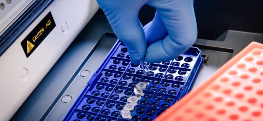 A closeup shot of a laboratory worker arranging pipette tips in a blue container for a testing