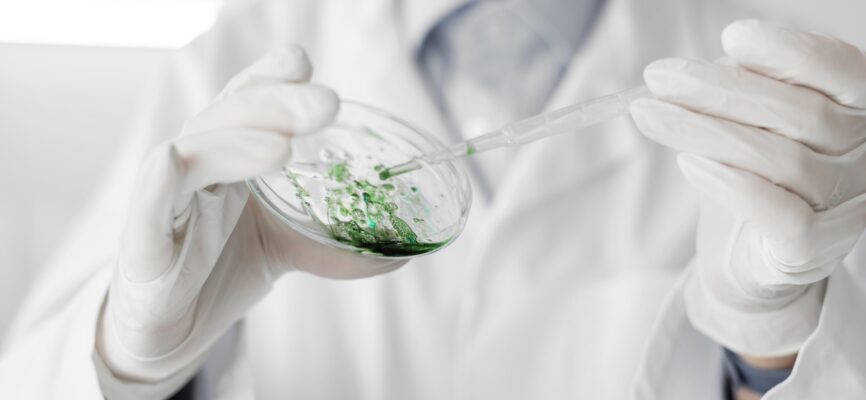 Cell Culture Contamination