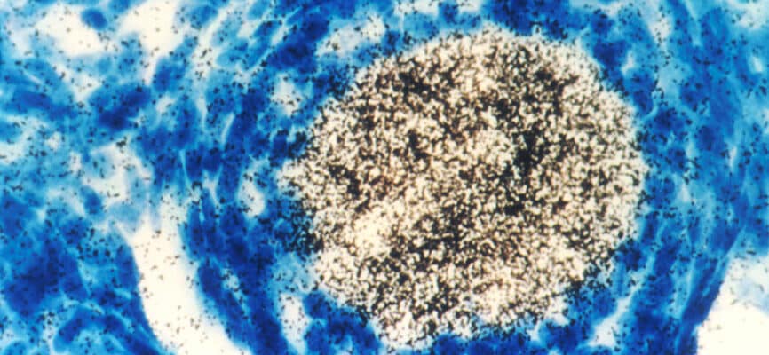 Oncogene 1 3
